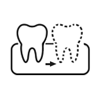 歯牙移植・再植